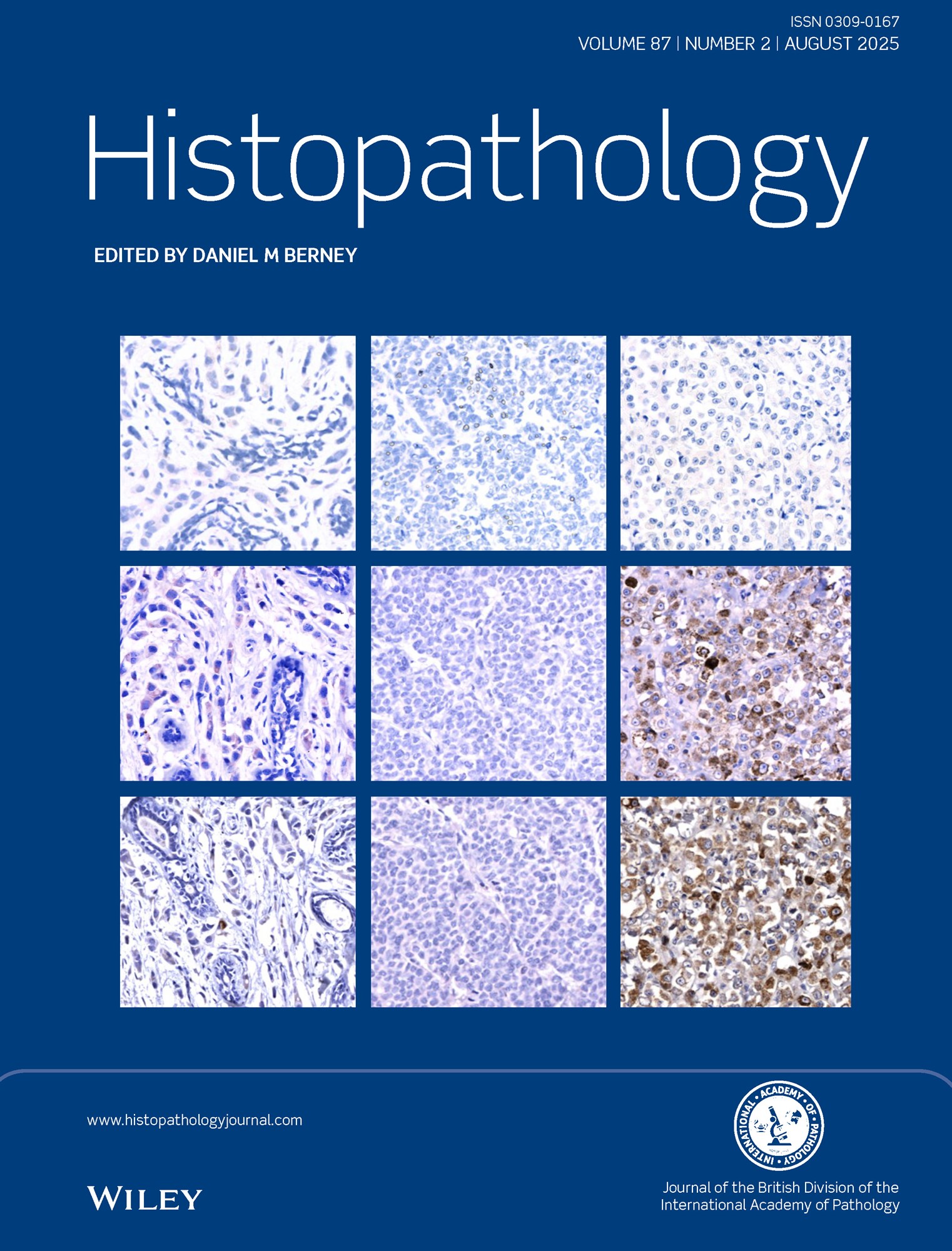 Histopathology Journal: Latest Issue Now Available image
